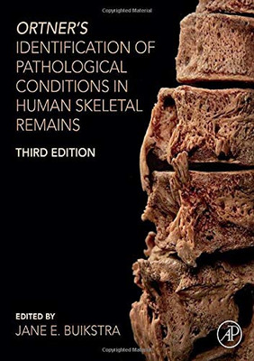 Ortner'S Identification Of Pathological Conditions In Human Skeletal Remains