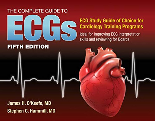 The Complete Guide To Ecgs: A Comprehensive Study Guide To Improve Ecg Interpretation Skills: A Comprehensive Study Guide To Improve Ecg Interpretation Skills