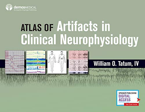 Atlas Of Artifacts In Clinical Neurophysiology
