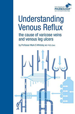 Understanding Venous Reflux The Cause Of Varicose Veins And Venous Leg Ulcers: Varicose Veins And Venous Leg Ulcers (College Of Phlebology)