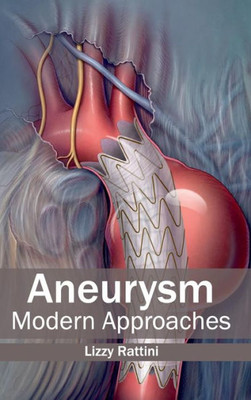 Aneurysm: Modern Approaches
