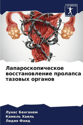 Лапароскопическое восс&#