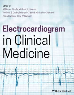 Electrocardiogram in Clinical Medicine