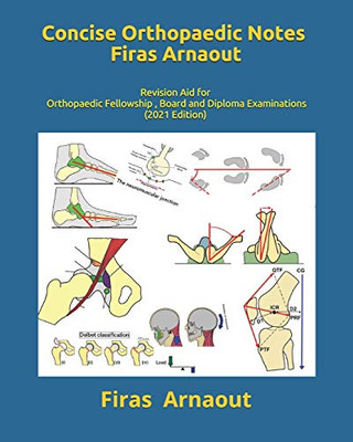 Concise Orthopaedic Notes: Revision aid for FRCS , EBOT , SICOT and Board Examinations