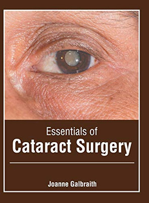 Essentials of Cataract Surgery