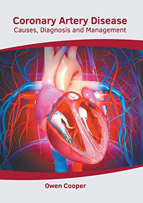 Coronary Artery Disease: Causes, Diagnosis and Management