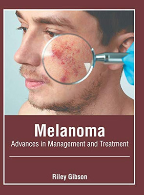 Melanoma: Advances in Management and Treatment