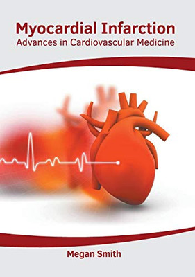 Myocardial Infarction: Advances in Cardiovascular Medicine