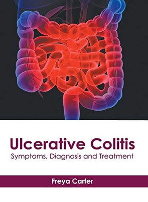 Ulcerative Colitis: Symptoms, Diagnosis and Treatment