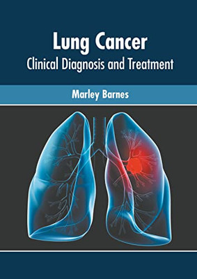 Lung Cancer: Clinical Diagnosis and Treatment