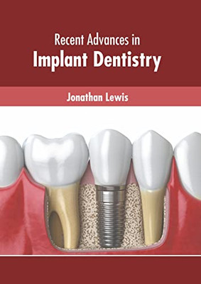 Recent Advances in Implant Dentistry
