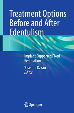 Treatment Options Before and After Edentulism: Implant Supported Fixed Restorations