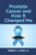 Prostate Cancer And How It Changed Me