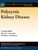 Polycystic Kidney Disease (Colloquium Integrated Systems Physiology: From Molecule To Function To Disease)