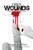 Open Wounds: The Healing Process