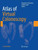 Atlas Of Virtual Colonoscopy