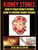 Kidney Stones: How To Treat Kidney Stones: How To Prevent Kidney Stones (Kidney Stone Treatment & Prevention Guide With All)