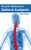 Recent Advances in Epidural Analgesia