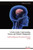 A Stroke Guide: Understanding, Factors, and Lifestyle Management: Understanding and Prevention the brainstroke