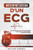 InterprÃ©tation d'un ECG: Un Guide Pratique et Intuitif pour Apprendre Ã  Lire un ECG et pour Diagnostiquer et Traiter les Arythmies