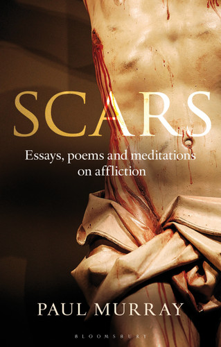 Scars: Essays, Poems and Meditations on Affliction book cover by Paul Murray OP