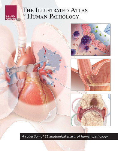 The Illustrated Atlas of Human Pathology book cover by 