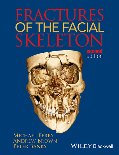 Fractures of the Facial Skeleton book cover by Michael Perry, Andrew Brown, Peter Banks