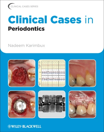 Clinical Cases in Periodontics (Clinical Cases (Dentistry)) book cover by 
