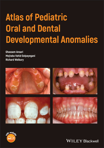 Atlas of Pediatric Oral and Dental Developmental Anomalies book cover by Ghassem Ansari, Mojtaba Vahid Golpayegani, Richard Welbury