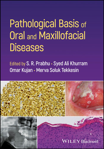 Pathological Basis of Oral and Maxillofacial Diseases book cover by 