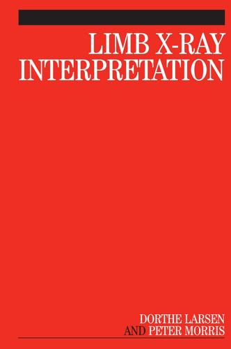 Limb X-Ray Interpretation book cover by Dorthe Larsen, Peter Morris