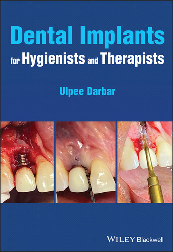 Dental Implants for Hygienists and Therapists book cover by Ulpee R. Darbar