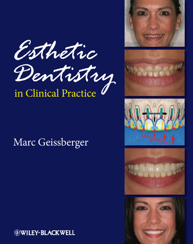 Esthetic Dentistry in Clinical Practice book cover by Marc Geissberger