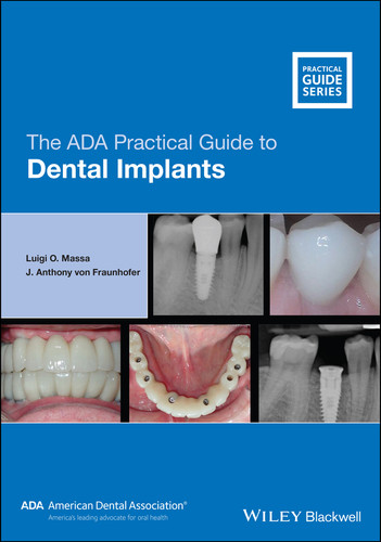 The ADA Practical Guide to Dental Implants (ADA Practical Guide) book cover by Luigi O. Massa, J. Anthony von Fraunhofer