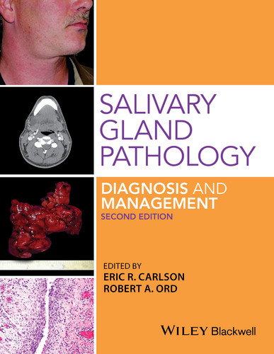 Salivary Gland Pathology: Diagnosis and Management book cover by Eric R. Carlson, Robert A. Ord