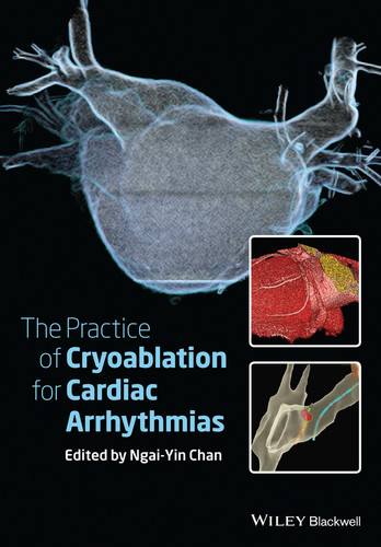 The Practice of Catheter Cryoablation for Cardiac Arrhythmias book cover by 