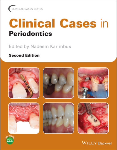 Clinical Cases in Periodontics (Clinical Cases (Dentistry)) book cover by 
