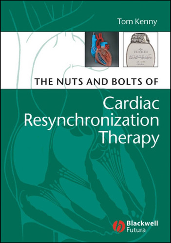 The Nuts and Bolts of Cardiac Resynchronization Therapy (Nuts and Bolts Series (Replaced by 5113)) book cover by Tom Kenny