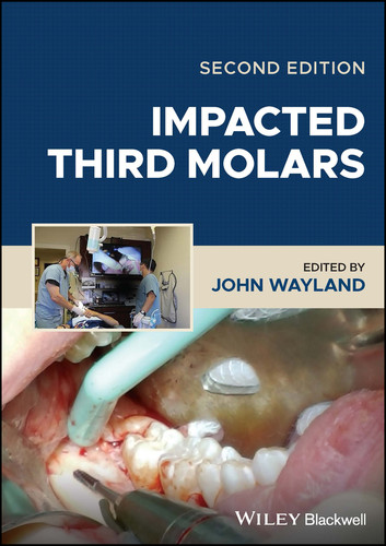 Impacted Third Molars book cover by 