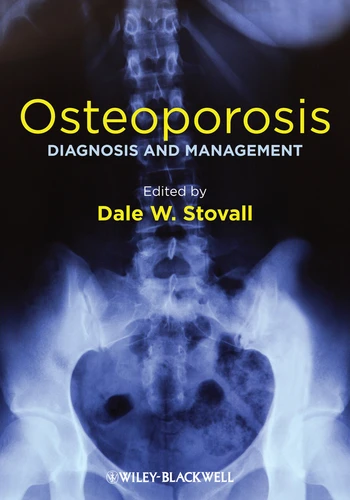 Osteoporosis: Diagnosis and Management book cover by 
