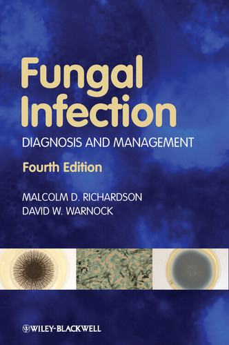 Fungal Infection: Diagnosis and Management book cover by Malcolm D. Richardson, David W. Warnock