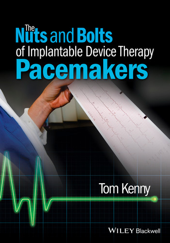 The Nuts and Bolts of Implantable Device Therapy: Pacemakers (The Nuts and Bolts Series) book cover by Tom Kenny