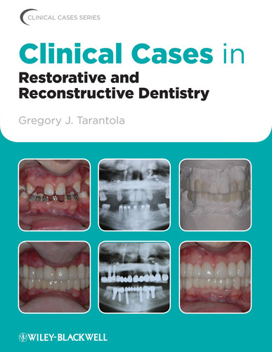Clinical Cases in Restorative and Reconstructive Dentistry (Clinical Cases (Dentistry)) book cover by Gregory J. Tarantola, DDS