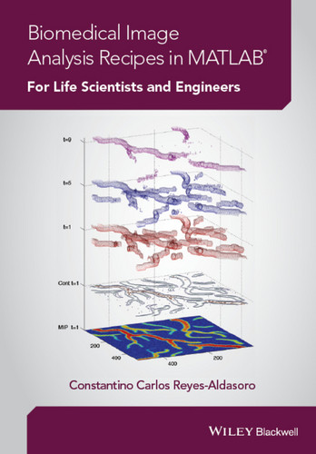 Biomedical Image Analysis Recipes in MATLAB: For Life Scientists and Engineers book cover by Constantino Carlos Reyes-Aldasoro