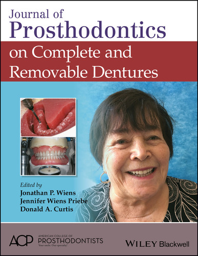 Journal of Prosthodontics on Complete and Removable Dentures book cover by 