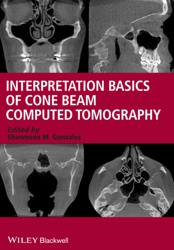 Interpretation Basics of Cone Beam Computed Tomography book cover by Shawneen M. Gonzalez