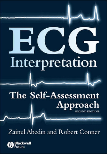 ECG Interpretation: The Self-Assessment Approach book cover by Zainul Abedin, Robert Conner