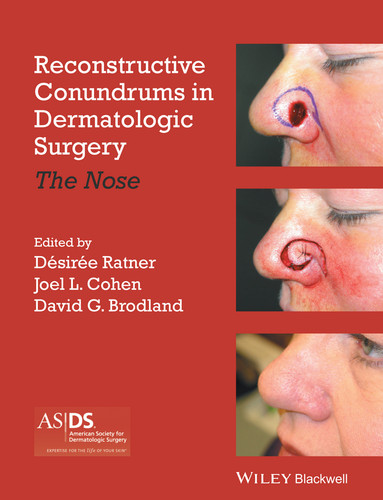 Reconstructive Conundrums in Dermatologic Surgery: The Nose book cover by 