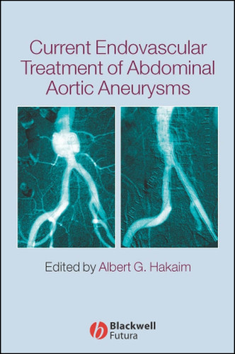 Current Endovascular Treatment of Abdominal Aortic Aneurysms book cover by 