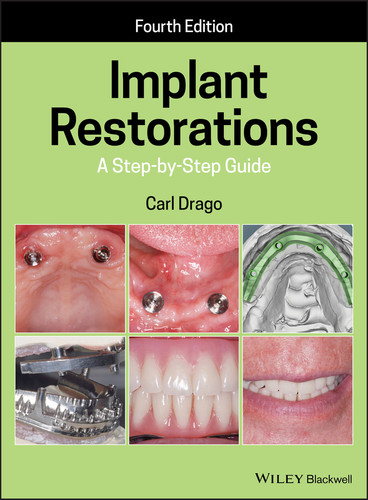 Implant Restorations: A Step-by-Step Guide book cover by Carl Drago